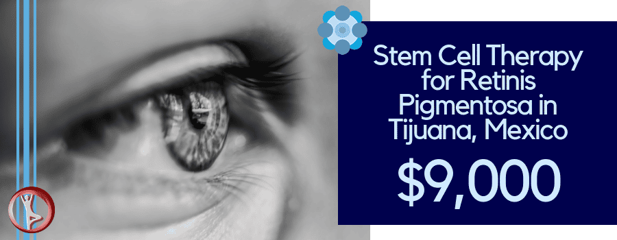 Price for Stem Cell Therapy for Retinitis Pigmentosa in Tijuana, Mexico